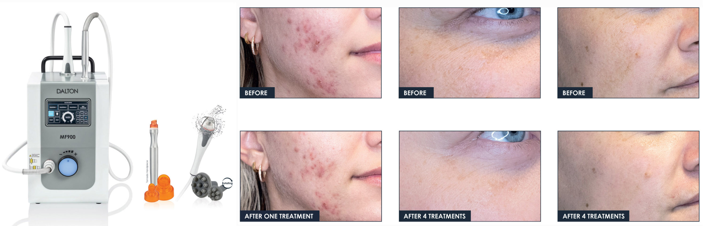 Marine Facial 900 B2B Flyer_ENG_RZ.indd